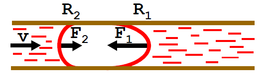 <p>What happens to the blood in the capillary when there’s a gas embolism?</p>