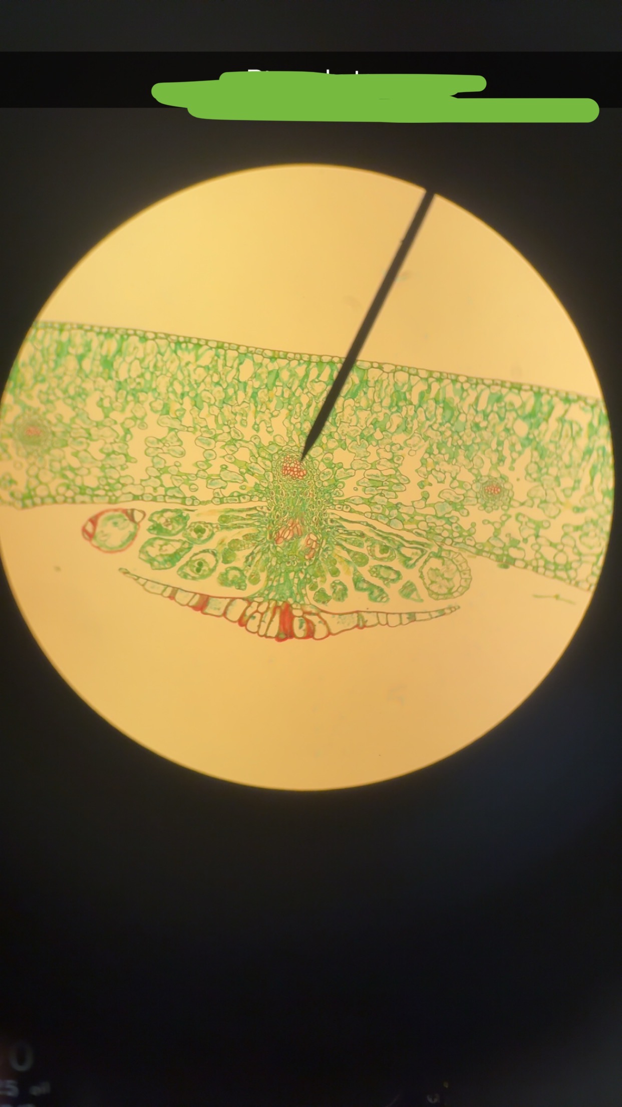 <p>What is the whole structure </p>