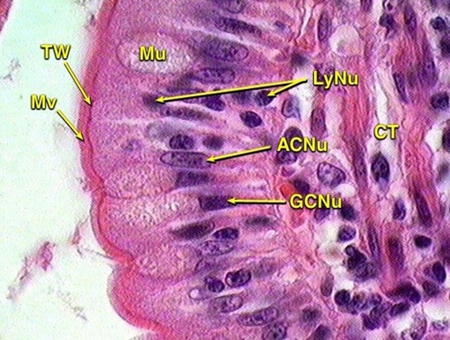 <p>ileum</p>