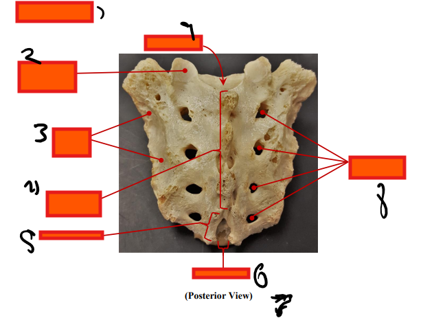 <p>posterior</p>