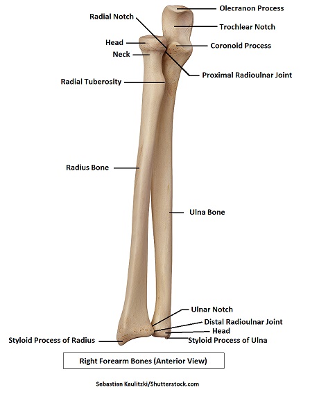 <p>Inferior level of Ulnar bone is moving away from radial bone. Styloid process is is medial</p>