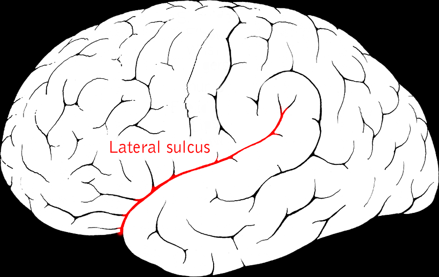 <p>separates temporal from frontal and occipital lobes </p>