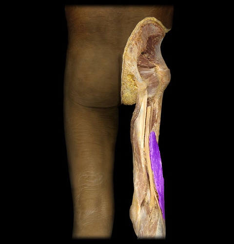 <p>origin: femur insertion: fibula action: flex leg</p>