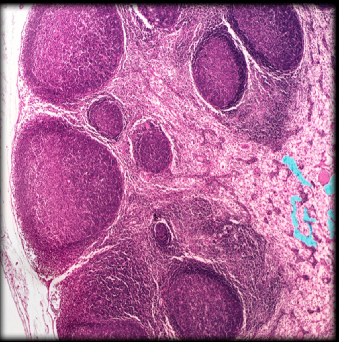 <p>Lymph node</p>