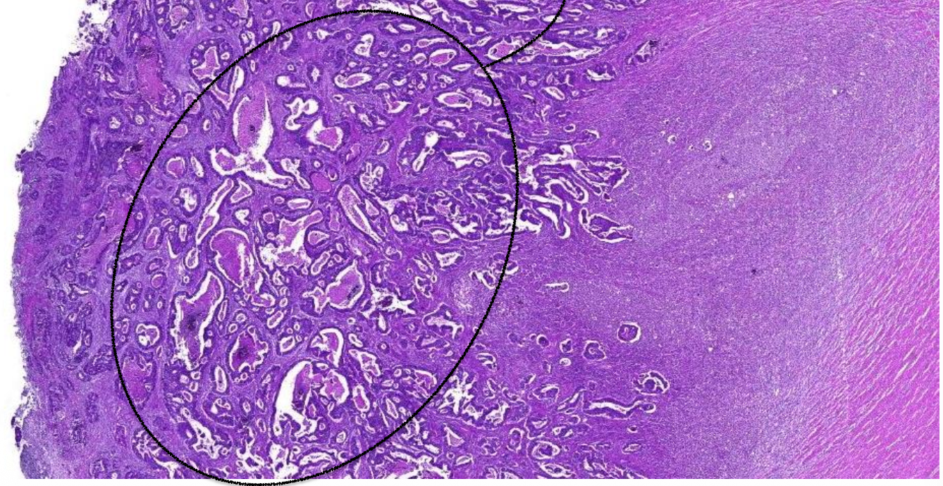 <p>Welk preparaat</p>