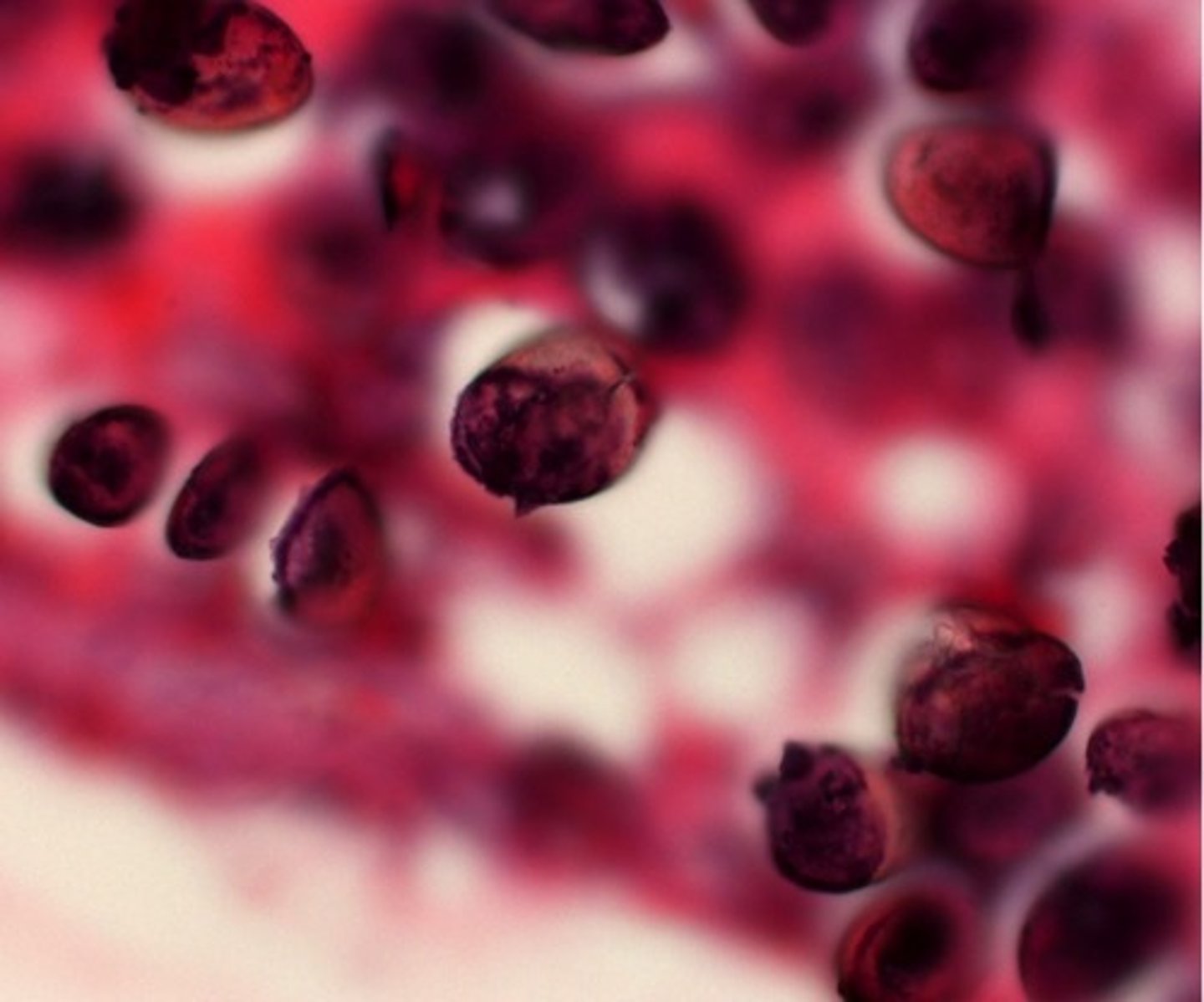 <p>Trematode/Blood Fluke</p><p>Transmission</p><p>-Contaminated H2O w/ cercariae from infected snails </p><p>Epidemiology</p><p>-Africa</p><p>-Middle East</p><p>-South America</p><p>-Caribbean</p><p>Tx</p><p>-Praziquantel</p>