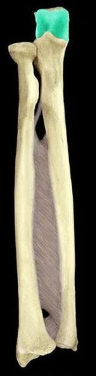 <p>ID depression shown in blue</p>