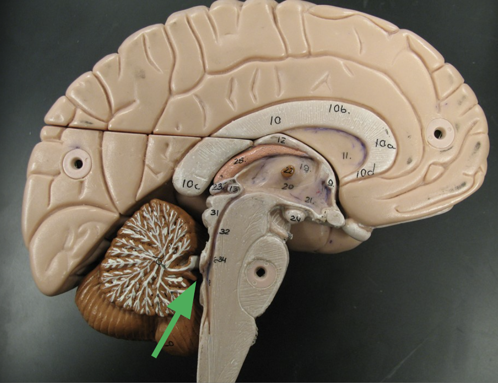 <p>Fourth ventricle</p>