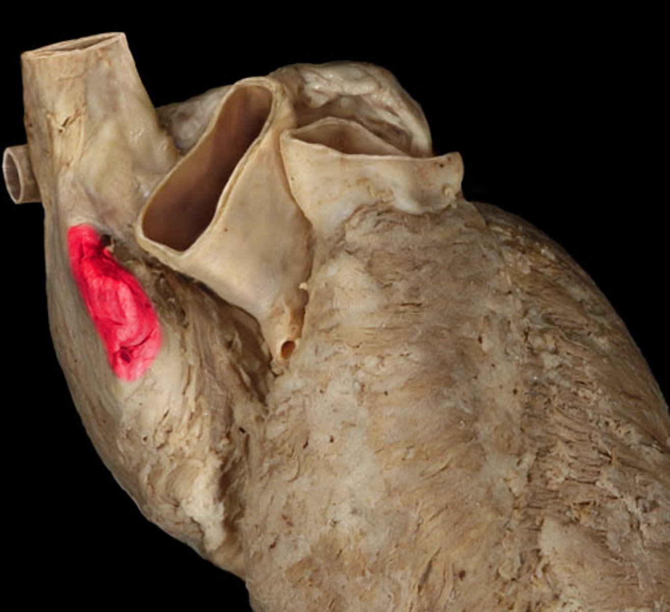 <p>Name the Structure of the Right Atrium</p>