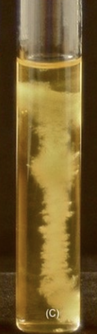 <p>What type of aerobe or anaerobe is this? (extra points if u can name the bacteria used)</p>