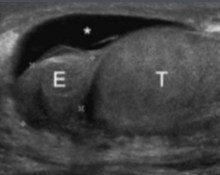 <p>This scan was done on a patient whose recently come down with a fever. What can be assumed here?</p>