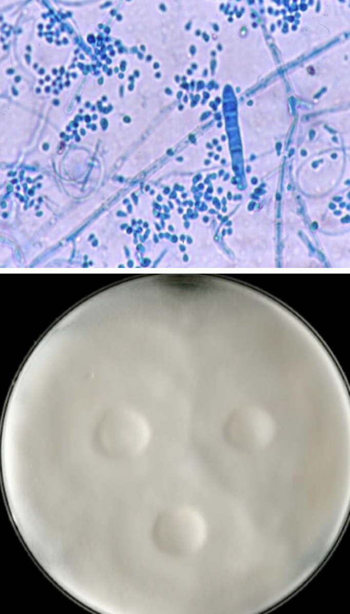 <p>Trichophyton mentagrophytes</p>