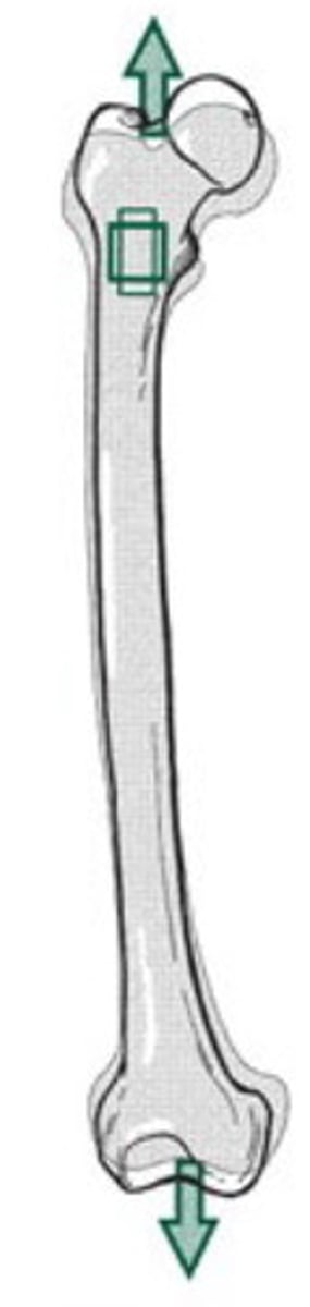 <p>pulling or stretching force directed normal to a surface (normal = perpendicular to the longitudinal axis); causes lengthening and/or narrowing</p>