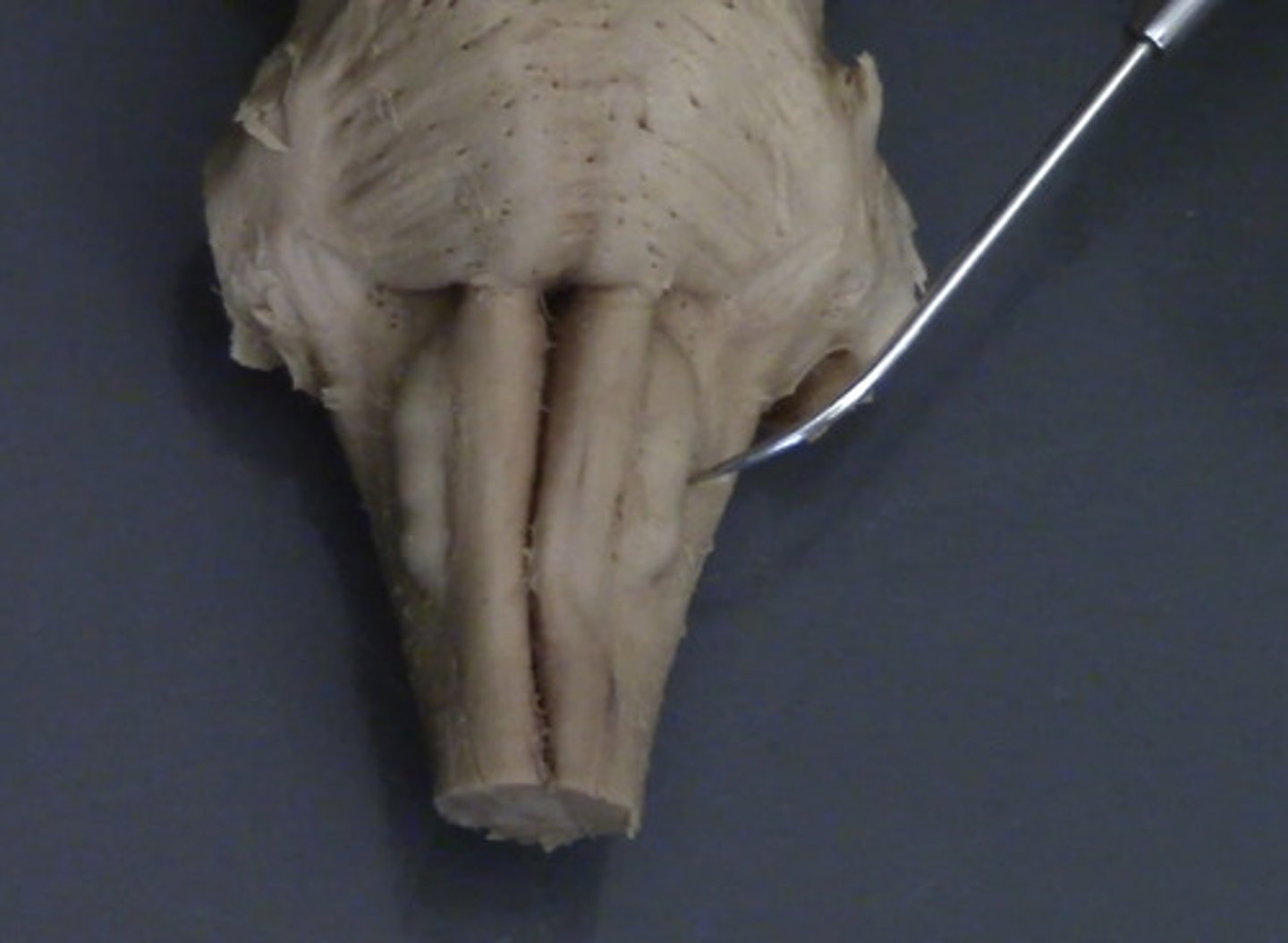 <p>Sulcus retroolivaris</p>