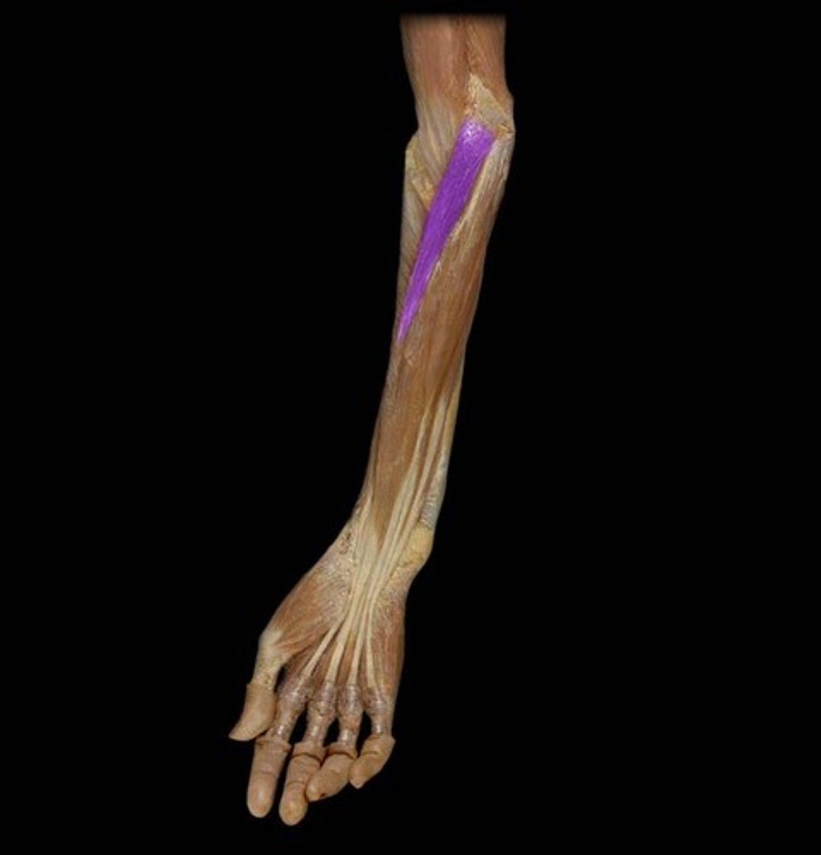 <p>Action: pronates forearm; weak flexor of elbow<br><br>Origin: Medial epicondyle of humerus; coronoid process of ulna<br><br>Insertion: Lateral radius</p>
