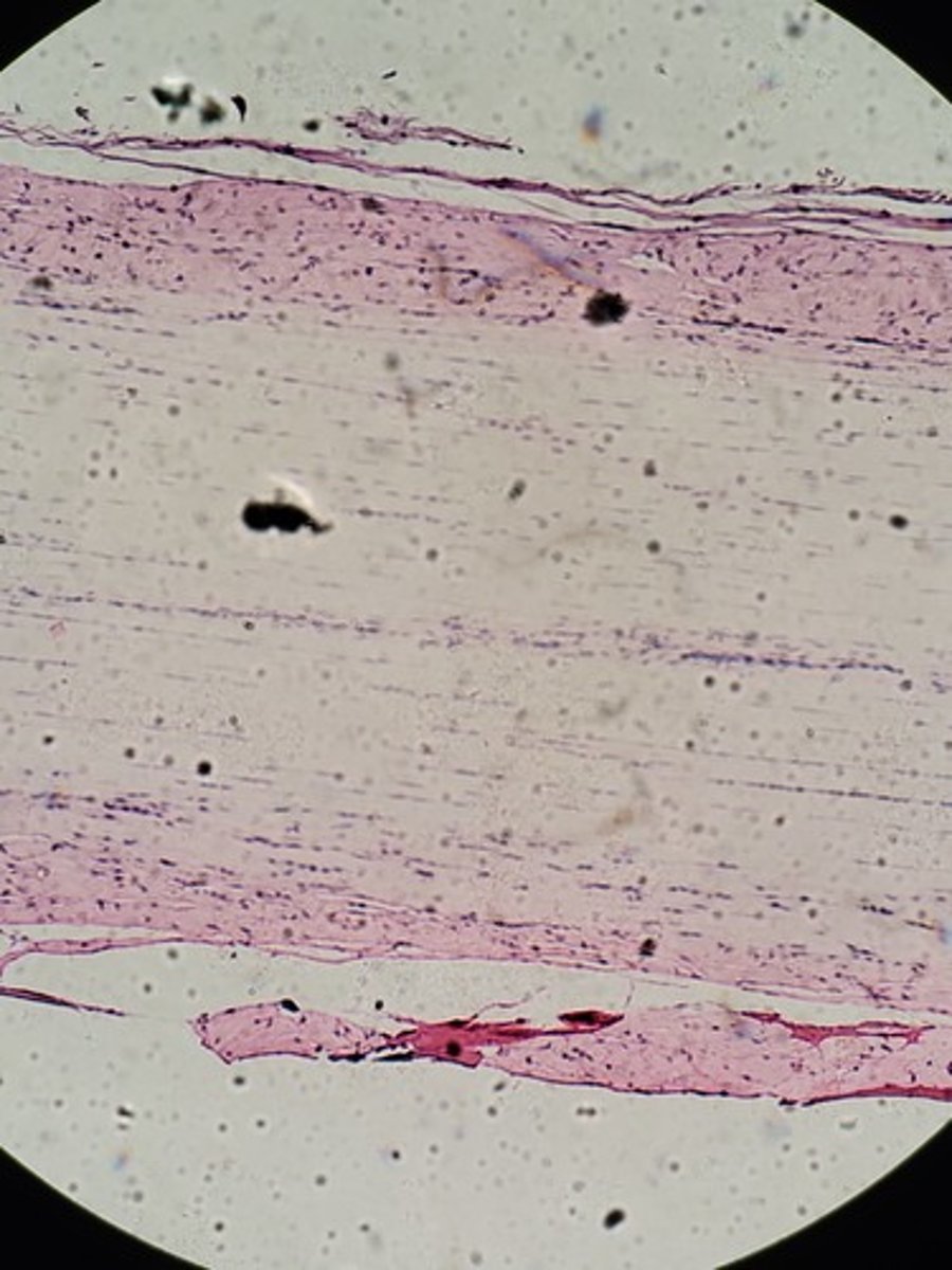 <p>Identify Tissue Type</p>