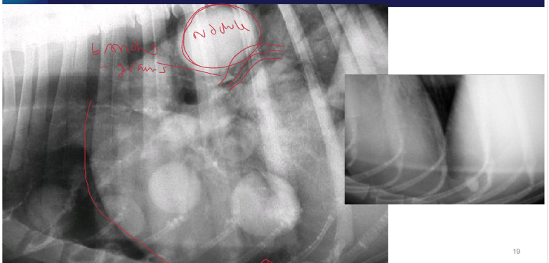 <p>What are the 2 lung patterns present here</p>