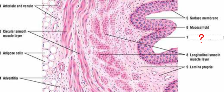 <p>what epithelium are the renal pelvis, ureters, and bladder composed of?</p>