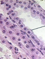 <ul><li><p><span style="background-color: transparent; font-family: "Book Antiqua", serif;"><span>Heavy and stout</span></span></p></li><li><p><span style="background-color: transparent; font-family: "Book Antiqua", serif;"><span>Found in rings</span></span></p></li><li><p><span style="background-color: transparent; font-family: "Book Antiqua", serif;"><span>Found in organs that play a secretory role</span></span></p><ul><li><p><span style="background-color: transparent; font-family: "Book Antiqua", serif;"><span>Glands</span></span></p></li><li><p><span style="background-color: transparent; font-family: "Book Antiqua", serif;"><span>Kidneys</span></span></p></li><li><p><span style="background-color: transparent; font-family: "Book Antiqua", serif;"><span>Ovaries</span></span></p></li></ul></li></ul><p></p>