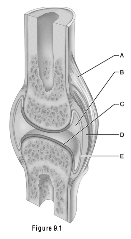 <p>This is a ligament; it connects bone to bone and is external to the joint capsule.</p>