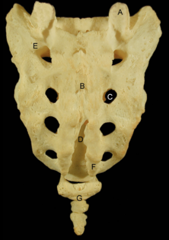 <p>Identify the structures of the Sacrum &amp; Coccyx - Posterior View</p>