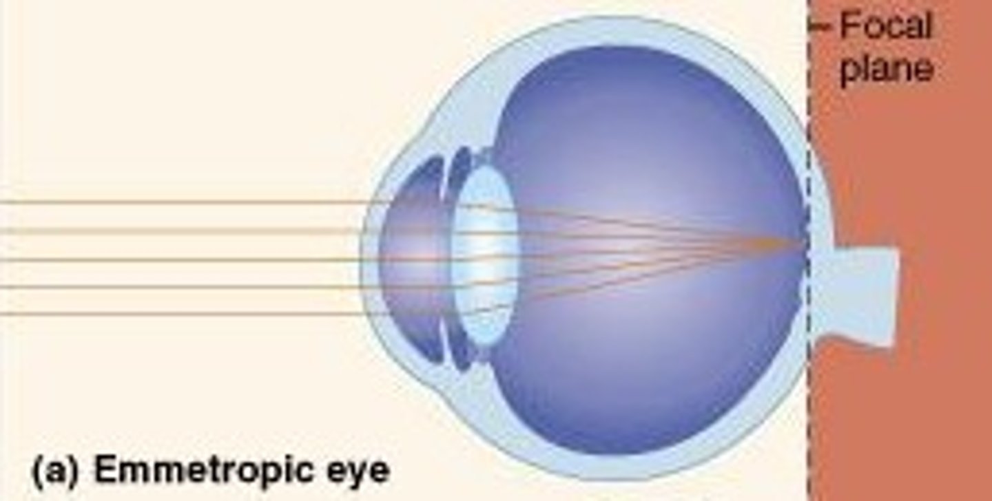 <p>falls on the retina or image plane</p>