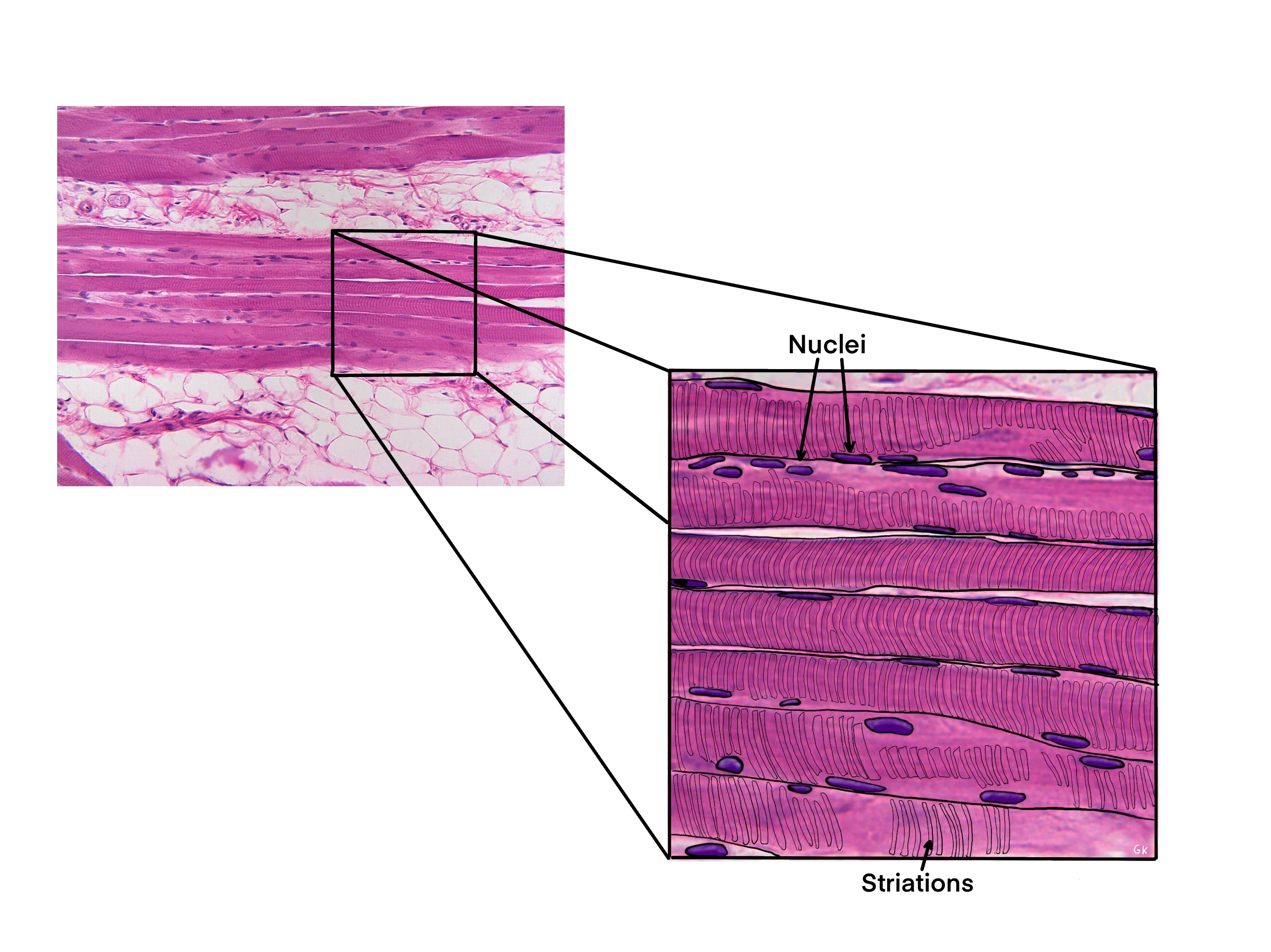 <p>Where are nuclei in the skeletal muscle cell? </p>
