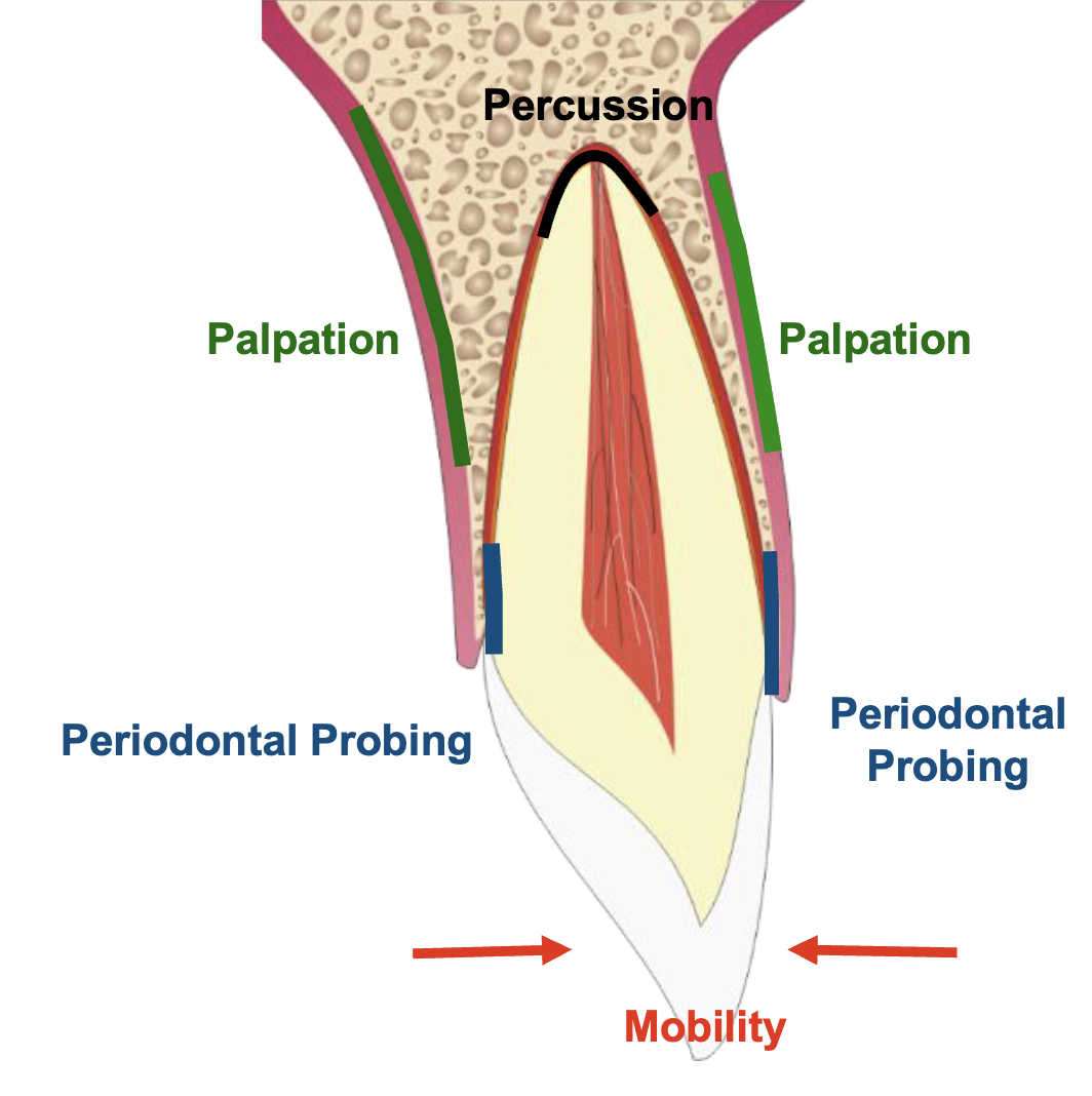 <ol><li><p>Percussion</p></li><li><p>Palpation</p></li><li><p>Probing</p></li><li><p>Mobility</p></li></ol><p></p>