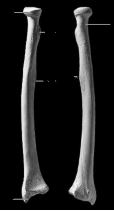 <p>Identify the radial head</p>