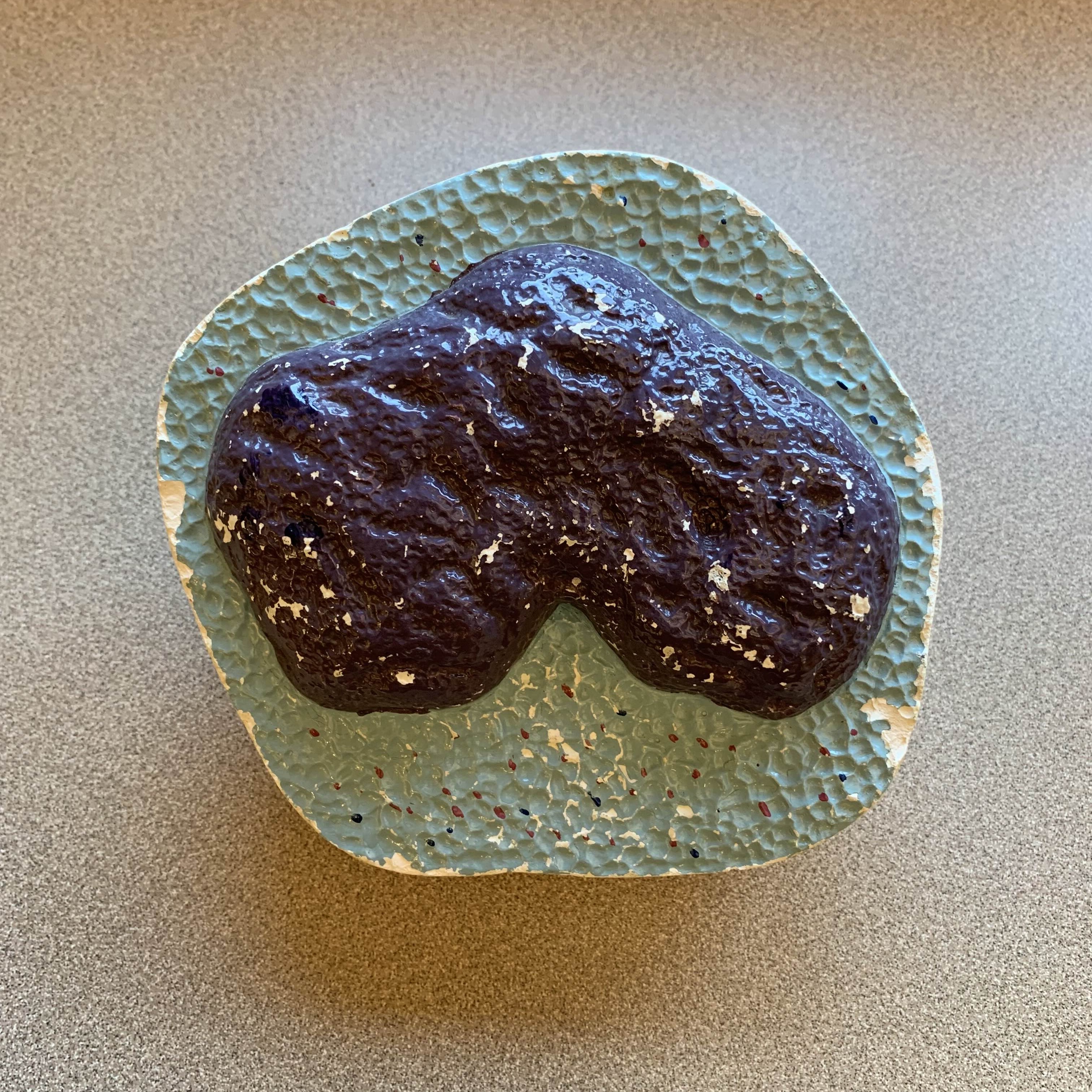 <p>Which type of WBC (leukocytes):</p><p>__ - (2-6%) largest cells in blood, nuclei can be round, oval, lobed indented.</p><p>→ Chronic infection, Hodgkin’s</p>