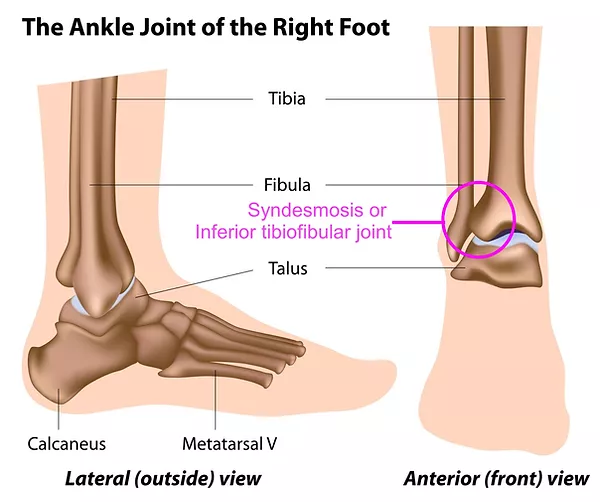 Prevent excessive rotation of the fibula on the tibia