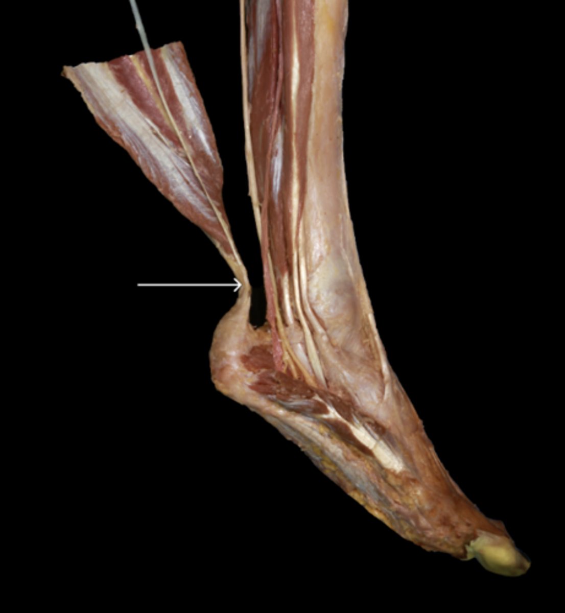 <p>Identify the tendon</p>