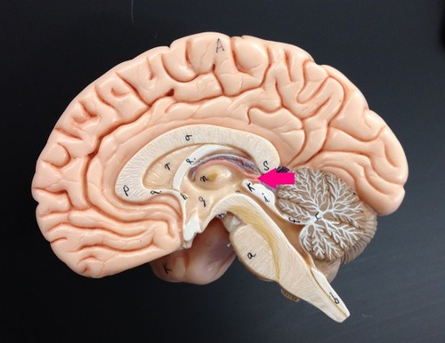 <p>Identify the gland.</p>
