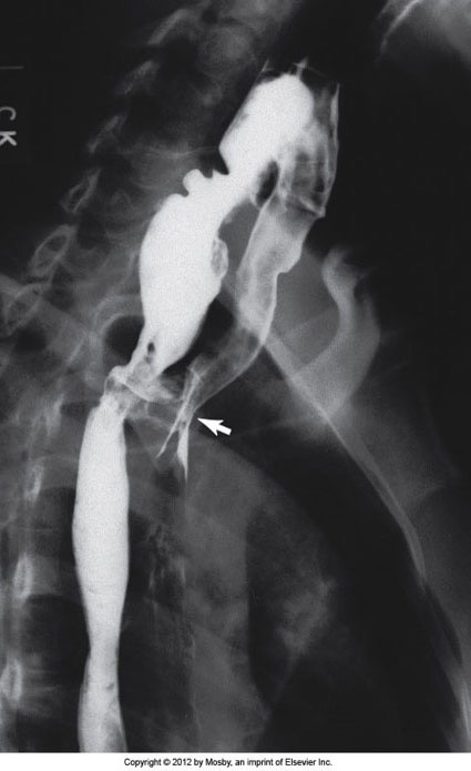 term image