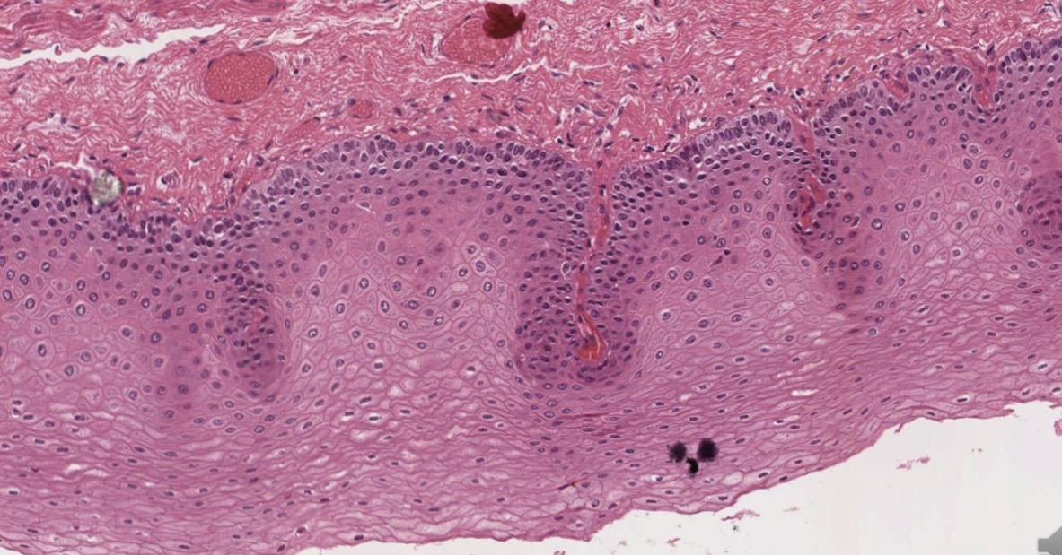 <p>Epitelio estratificado plano no cornificado</p>
