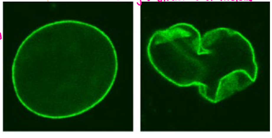 <p>How is a progeria cell different than a normal cell</p>