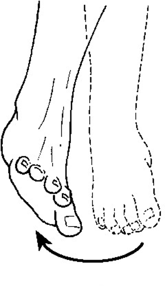 <p>Turning the sole of the foot laterally (outward).</p>
