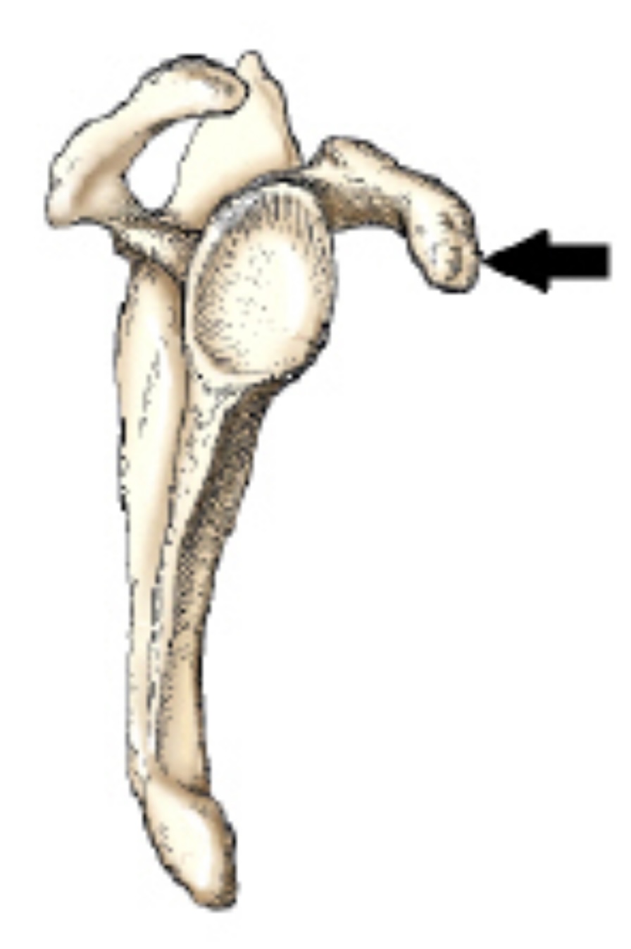 <p>The bone part identified by the arrow in this figure is the:</p>