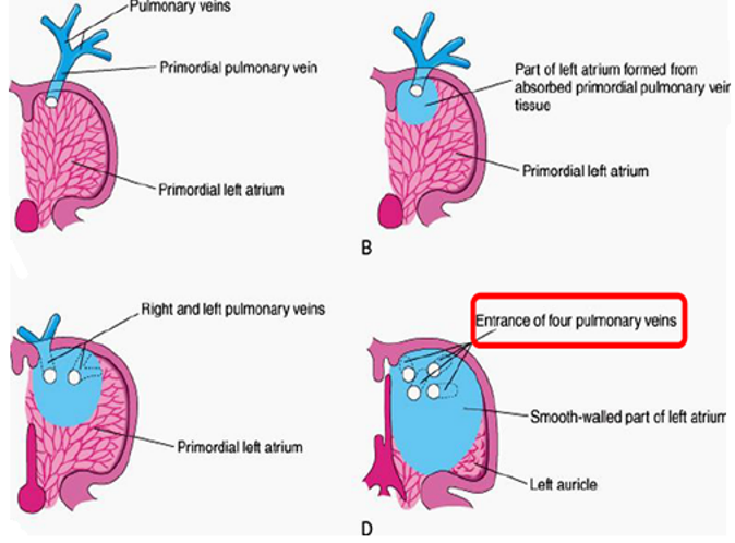 <p>Formed partly from <strong><mark data-color="red">common atrium absorption of the primordial pulmonary vein</mark></strong></p>