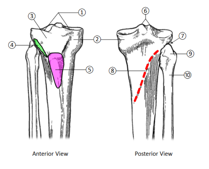 <p>Medial condyle</p>