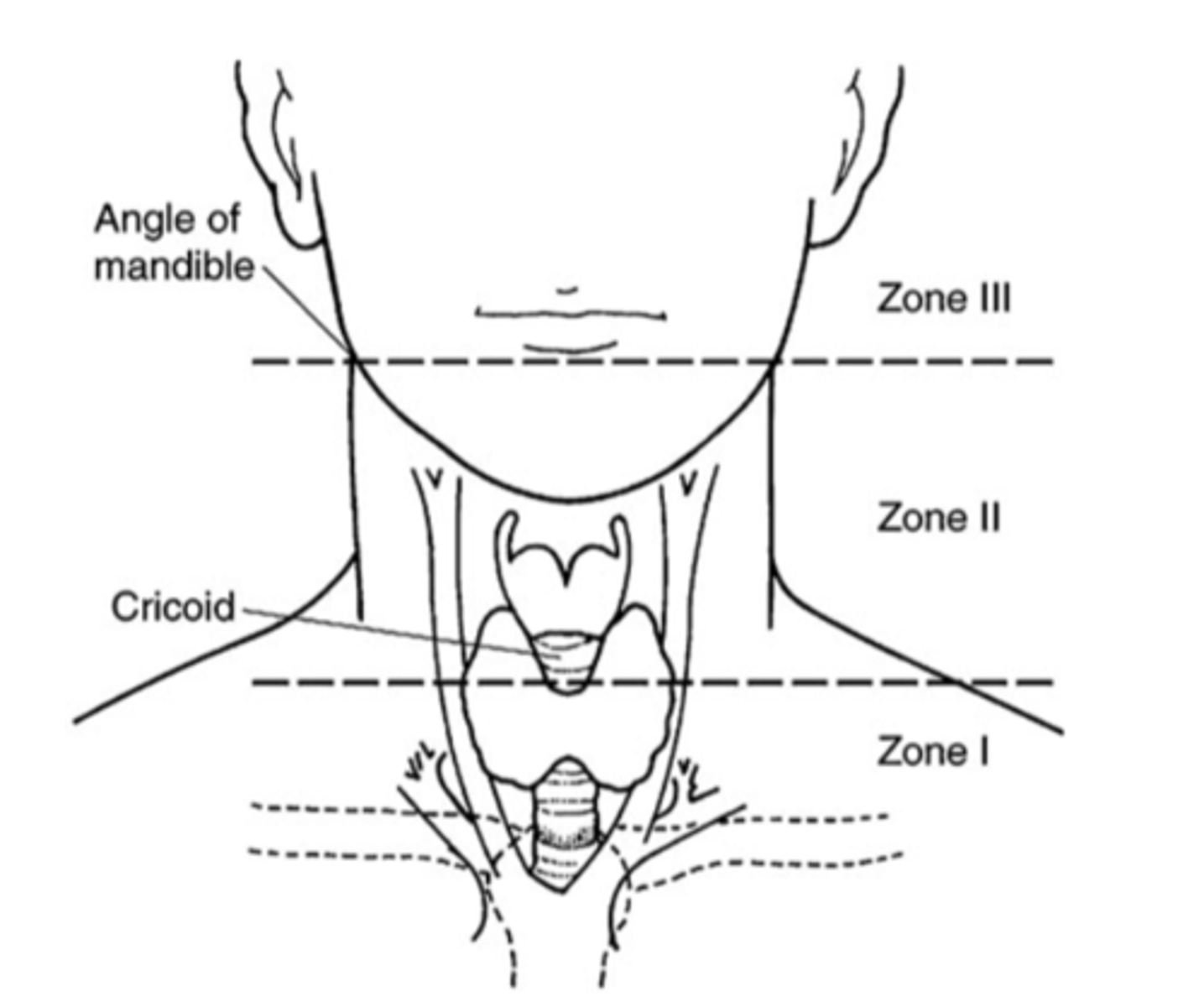 <p>Zone I</p><p>Zone II</p><p>Zone III</p>