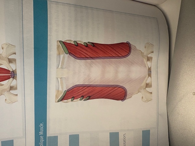 <p>External oblique</p>