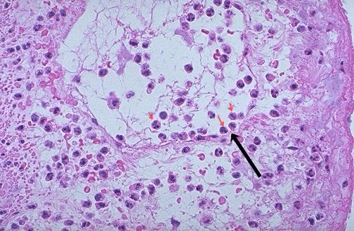 <ol><li><p>Identify pointed in red arrows</p></li><li><p>Identify pointed in black arrows</p></li><li><p>Describe the process of the cells pointed in red arrow</p></li></ol>