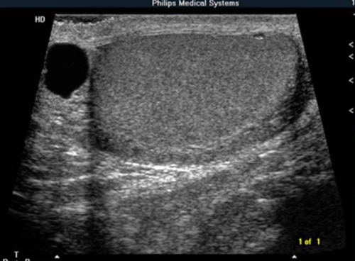 <p><span><span>THIS IMAGE REPRESENTS WHICH OF THE FOLLOWING:</span></span><br><span><span>transverse image of the testicle</span></span><br><span><span>sagittal image of the testicle</span></span><br><span><span>transverse image of the testicle with a hydrocele</span></span><br><span><span>sagittal image of the testicle with an epididymal cyst</span></span></p>