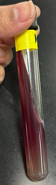 <p><strong>LIA Test</strong></p><p>In this tube, what is the result for deamination and decarboxylation?</p>