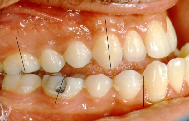 <p>classification?</p>