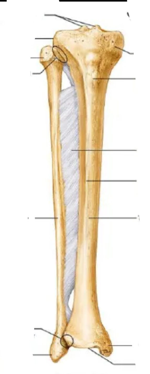 <p>Bone? View? Left or right?</p>