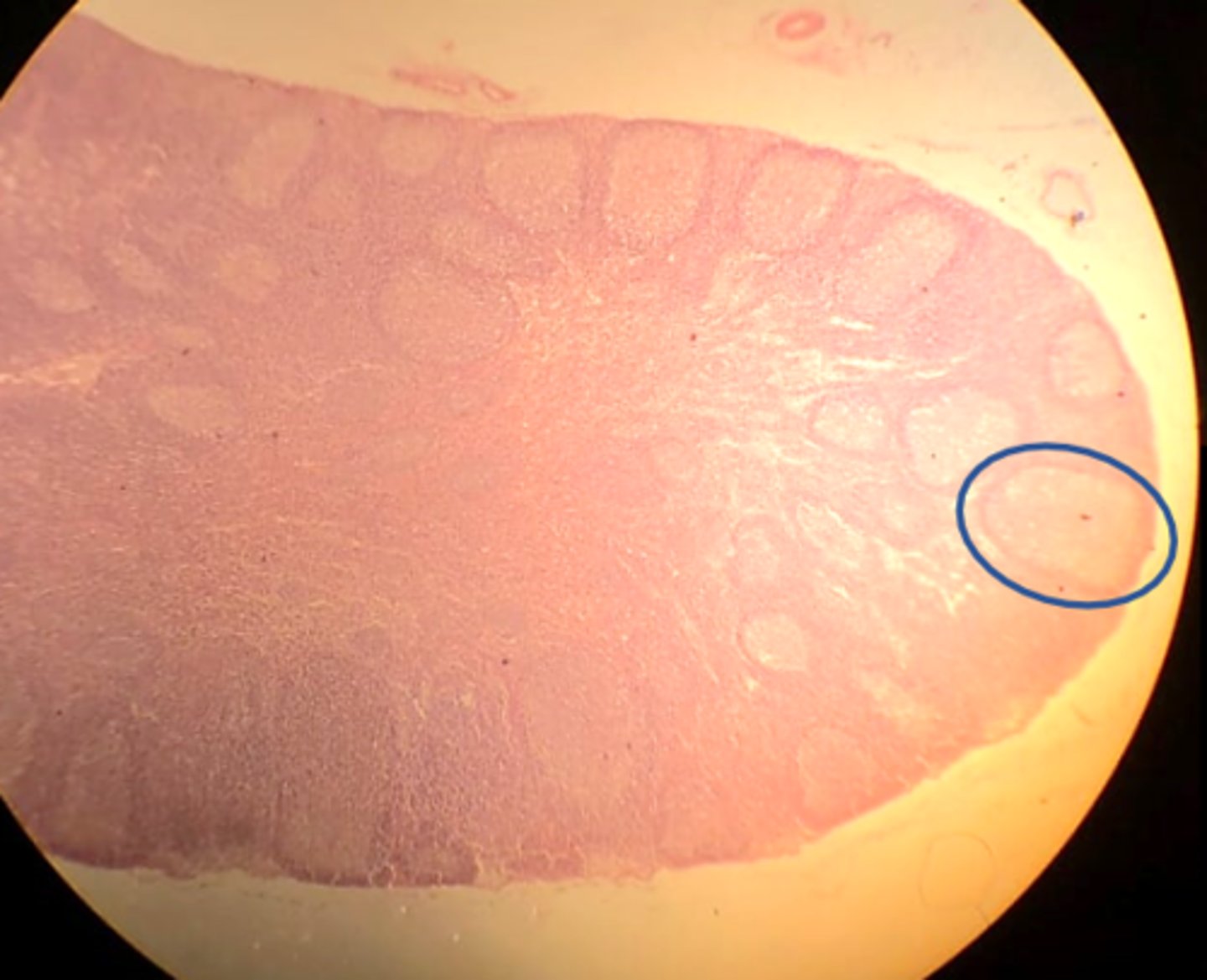 <p>What is circled?</p>