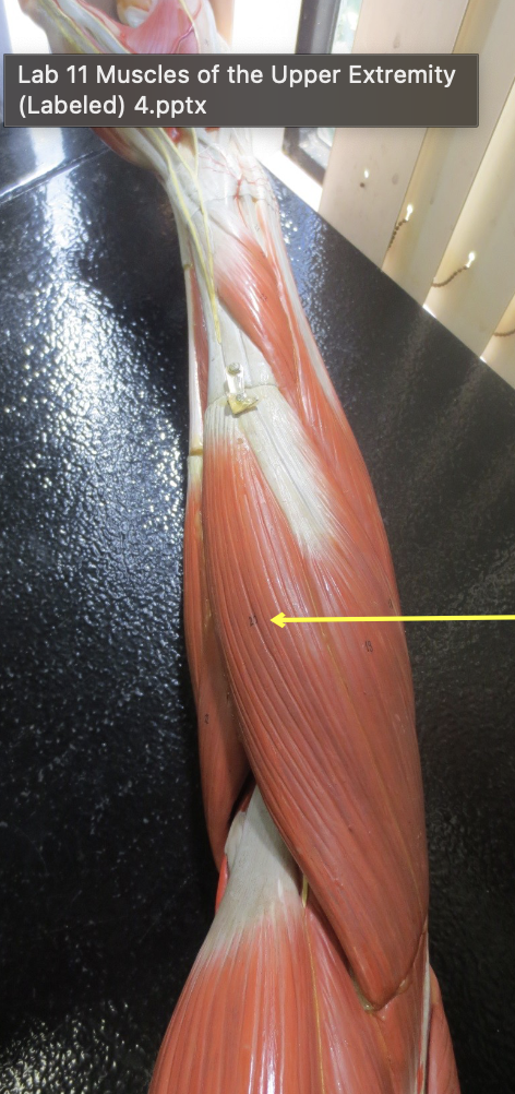 <p>Which muscle</p>