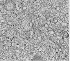 <p>What is the function of the Smooth Endoplasmic Reticulum?</p>